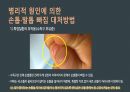 응급간호(손톱, 발톱 빠짐) 발표자료 6페이지