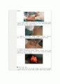 성인간호실습 수술실 케이스 - 갑상선암(다빈치 로봇 갑상선절제술) 수술과정+간호과정 5개 (A+) 14페이지