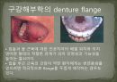 세미나자료 구강해부학의 총의치(덴쳐) 제작(치의학, 치기공, 치위생) 8페이지