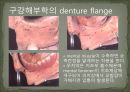 세미나자료 구강해부학의 총의치(덴쳐) 제작(치의학, 치기공, 치위생) 16페이지