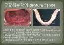 세미나자료 구강해부학의 총의치(덴쳐) 제작(치의학, 치기공, 치위생) 20페이지