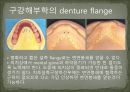 세미나자료 구강해부학의 총의치(덴쳐) 제작(치의학, 치기공, 치위생) 23페이지