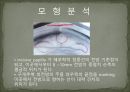 세미나자료 구강해부학의 총의치(덴쳐) 제작(치의학, 치기공, 치위생) 38페이지