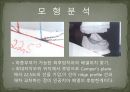 세미나자료 구강해부학의 총의치(덴쳐) 제작(치의학, 치기공, 치위생) 41페이지