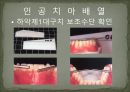 세미나자료 구강해부학의 총의치(덴쳐) 제작(치의학, 치기공, 치위생) 61페이지