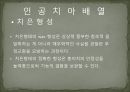 세미나자료 구강해부학의 총의치(덴쳐) 제작(치의학, 치기공, 치위생) 79페이지