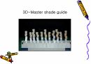 세미나자료 세라믹을 위한  치주조직과 색조 3D-Master Shade Taking 30페이지
