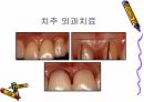 세미나자료 세라믹을 위한  치주조직과 색조 3D-Master Shade Taking 54페이지
