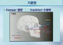 세미나자료 치과보철학 임플란트 시스템에 대해서 알아보자(치의학, 치기공, 치위생) 17페이지