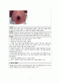 A+ 간호과정보고서_신생아제대감염,저나트륨혈증_진단3개 4페이지