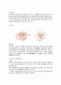 간호학과 여성 병동 실습  /  3-1 여성건강간호학 케이스(질 탈출증) 학점 A+ 5페이지