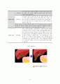 담낭염 casestudy(간호진단 3개, 간호과정 3개, 담관폐쇄와 관련된 급성통증, 염증과 관련된 고체온, 수술과 관련된 불안) 10페이지