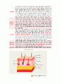 A+받은 자료 BURN CASE STUDY 화상 케이스 스터디 3페이지