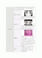 A+ [ 아동간호학 간질성 폐렴 케이스 스터디 ] 간호진단-과정 1. 가스교환장애 2. 애착장애 위험성 6페이지