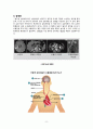 성인간호학 심방세동 Case study(간호과정, 간호진단) A+ 10페이지