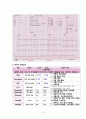 성인간호학 심방세동 Case study(간호과정, 간호진단) A+ 17페이지