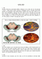 파킨슨병 간호사례연구case study-간호과정 2가지 레포트 실습점수 A+자료!!(파킨슨병 케이스스터디, 파킨슨병 컨퍼런스, 파킨슨병 실습 자료) 3페이지