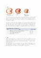 응급간호학 실습 질환보고서 만성신부전 Chronic renal failure CRF 2페이지
