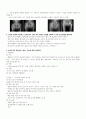 성인간호학 실습 고관절 골절 골다공증 만성신부전증 CASE STUDY 간호과정 레포트 2페이지