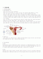 A+ 자궁근종 케이스 스터디 (급성통증 비롯한 간호진단 5개, 간호중재 10개, 퇴원교육자료, 대본까지) 3페이지