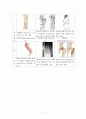 성인건간간호학 / 경골골절 / other fracture of shaft of tinia, open / 진단5 과정2 중재21 11페이지