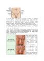 탈장 hernia 수술실 케이스 4페이지