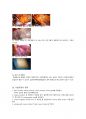 탈장 hernia 수술실 케이스 10페이지