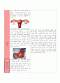 여성간호 사례연구 자궁내막종 4페이지
