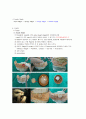 temporary crown 2페이지
