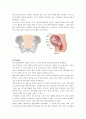 질병보고서-아두골반 불균형(CPD, Cephalopelvic disproportion) 2페이지
