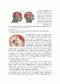 성인간호학실습 case 외상성경막하출혈 [A+자료입니다!] 간호진단 및 과정 2개 6페이지