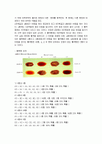 혈액의 응고 반응 관찰 실험 3페이지