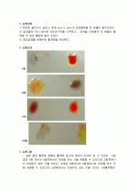 혈액의 응고 반응 관찰 실험 4페이지