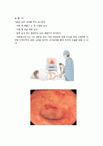 간호진단 대장염 케이스 4페이지