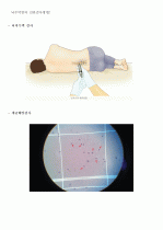 [2016/09]뇌수막염 case(뇌수막염의 정의, 뇌수막염의 원인, 뇌수막염의 증상, 뇌수막염의 진단검사 방법, 뇌수막염의 예방 방법, 뇌수막염 환자의 CASE)  5페이지