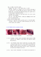 코기 기능 구조 질병 수술 9페이지