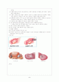 골반 염증성 질환 5페이지