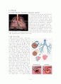 [성인간호]만성폐쇄성폐질환(COPD) case study 2페이지