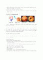 내시경의 종류, 검사방법 및 간호  5페이지