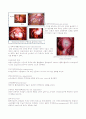 Leiomyoma of uterus, unspecified 2페이지