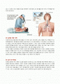 기관지경 검사(Bronchoscopy) 2페이지