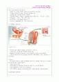 Congenital megacolon (선천성거대결장) 7페이지