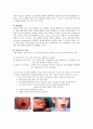 [간호학]가와사키(Kawasaki disease) 2페이지