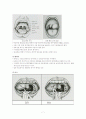 [간호학]Tonsillectomy(수술실 실습) 7페이지