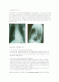 Pacemaker [인공심박동기] 2페이지