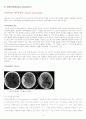 레포트월드 epidural hemorrhage 4페이지