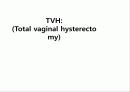 TVH (질식자궁절제술 :Total vaginal hysterectomy) 1페이지