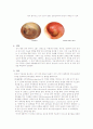 만성 중이염 (Chronic otitis media) 2페이지