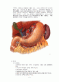 위암 case-Body of stomach, malignant neoplasm  2페이지