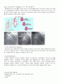케이스 스터디(Case Study) -  심근경색 (MI ; myocardial infarction) 7페이지